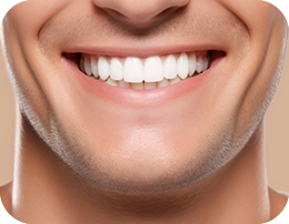 Zahnaufhellung-Langen-strahlendes-Laecheln