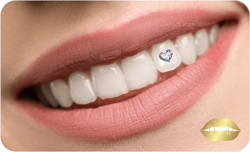 Zahnschmuck-Sonderform